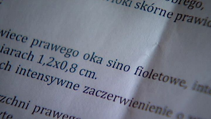 Oleśnica: Policjanci pobili na komisariacie dwóch przypadkowych mężczyzn