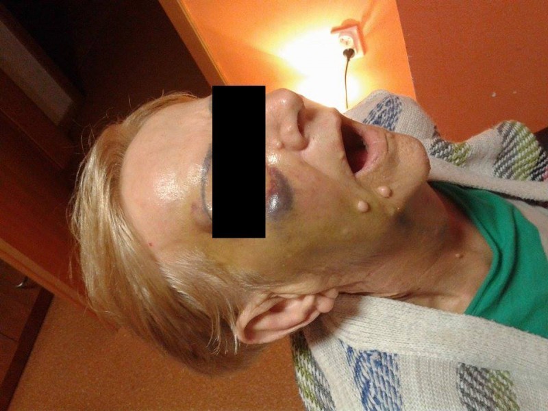 Hopowo k. Gdańska: Tortury w Domu Seniora. Prokurator umarza sprawę